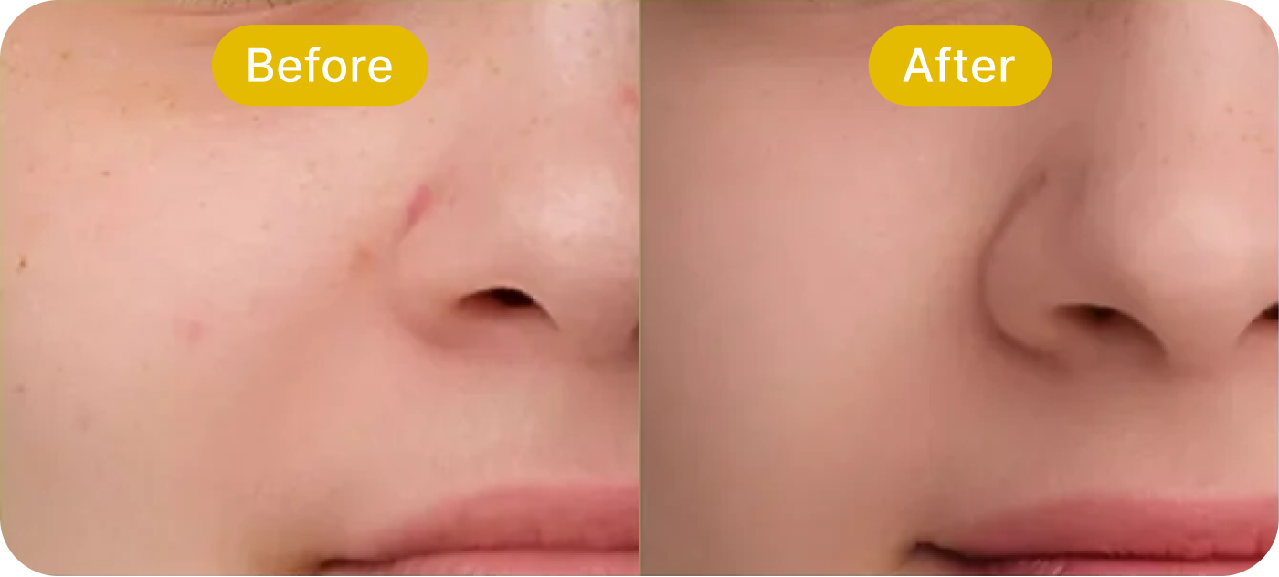 Left Image